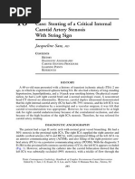 Case: Stenting of A Critical Internal Carotid Artery Stenosis With String Sign