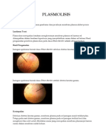 plasmolisis