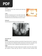 Mesiodens, Distomolar, Paramolar