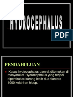 HIDROCEPHALUS