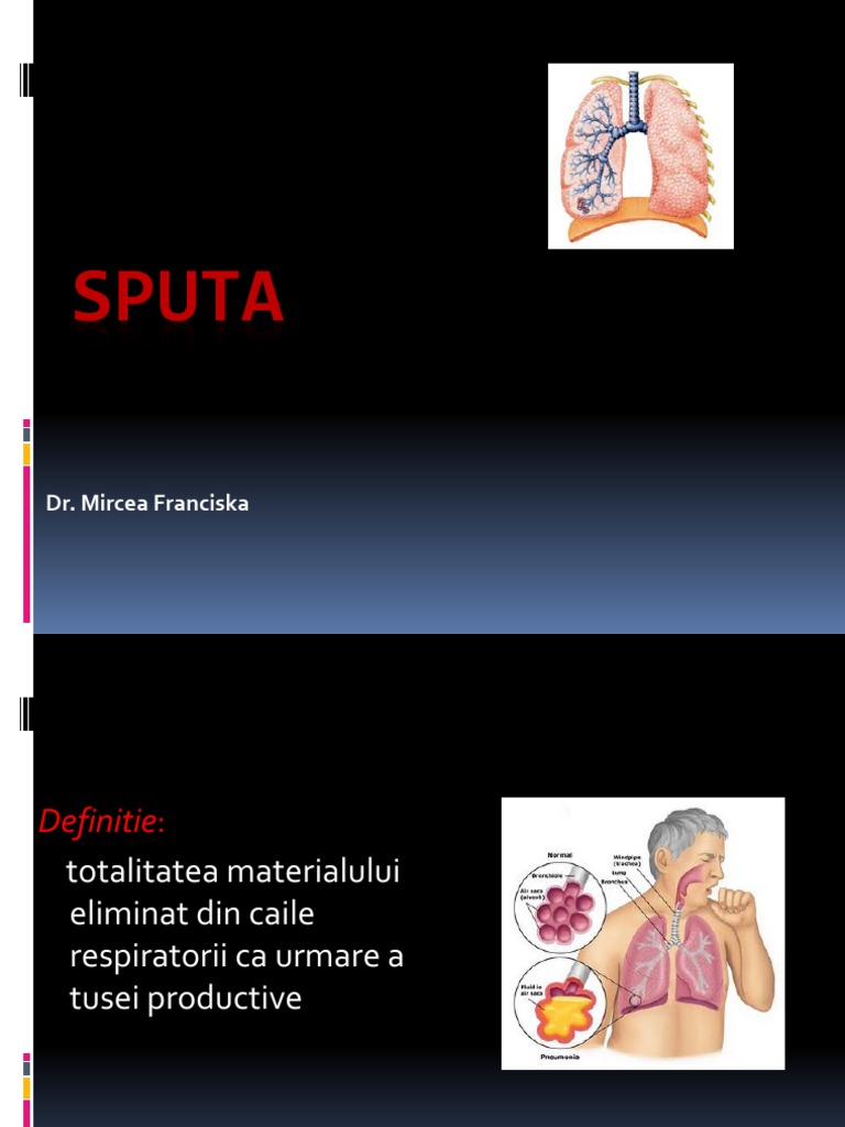 SPUTA Prezentare Imbunatatita | PDF