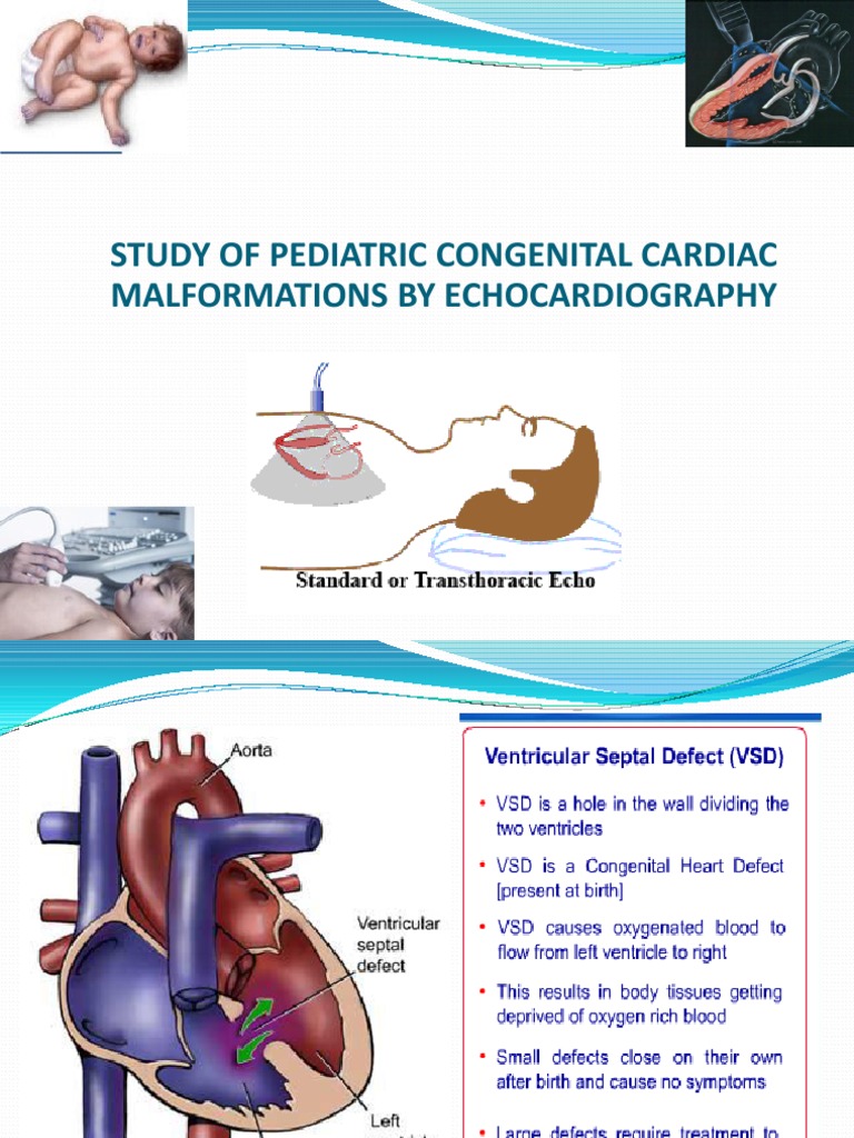 ECHOCARDIOGRAPHY IN PEDIATRIC AND CONGENITAL HEART DISEASE PDF DOWNLOAD visual data 7