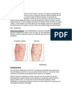 Reacciones alérgicas medicina