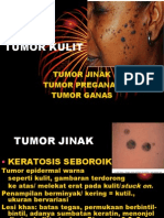 Tumor Kulit