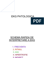 38122242 Ekg Patologica