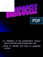 Varicocele