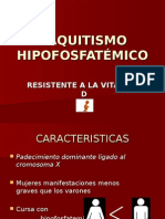 Raquitismo Hipofosfatémico