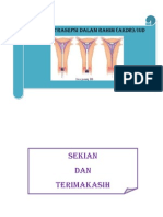 Alat Kontrasepsi Dalam Rahim (Akdr) /iud