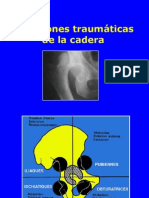 05- Luxaciones de La Cadera (1)