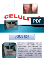 Celulitis