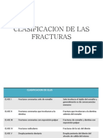 Clasificacion de Las Fracturas Dentales y Dentoalveolares Pediatricas