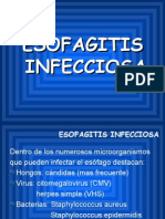 Esofagitis Infecciosa Expo