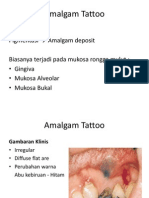 Amalgam Tattoo