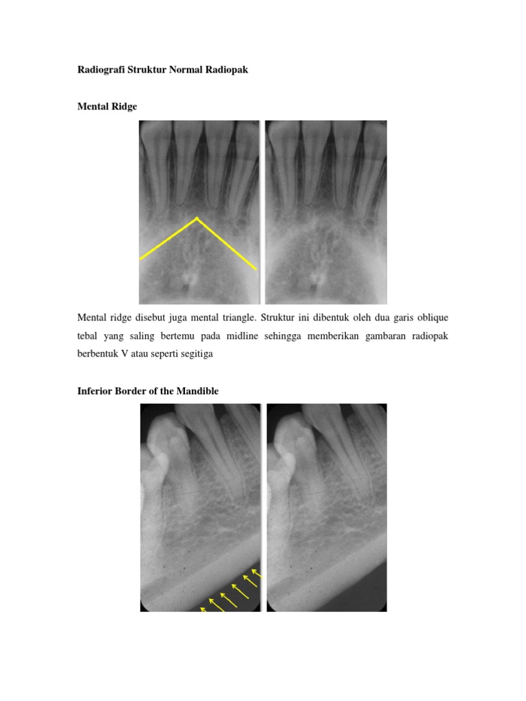 Radiografi Struktur Normal Radiopak | PDF | Sains & Matematika