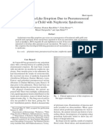 Pityriasis Rosea-Like Eruption Due To Pneumococcal Vaccine in A Child With Nephrotic Syndrome