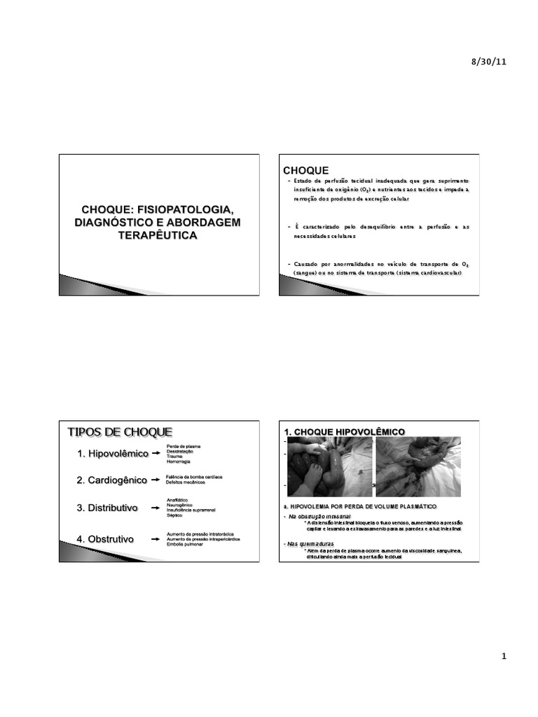 Tipos de Choque | PDF