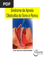 Sindrome Do Ronco Acupuntura