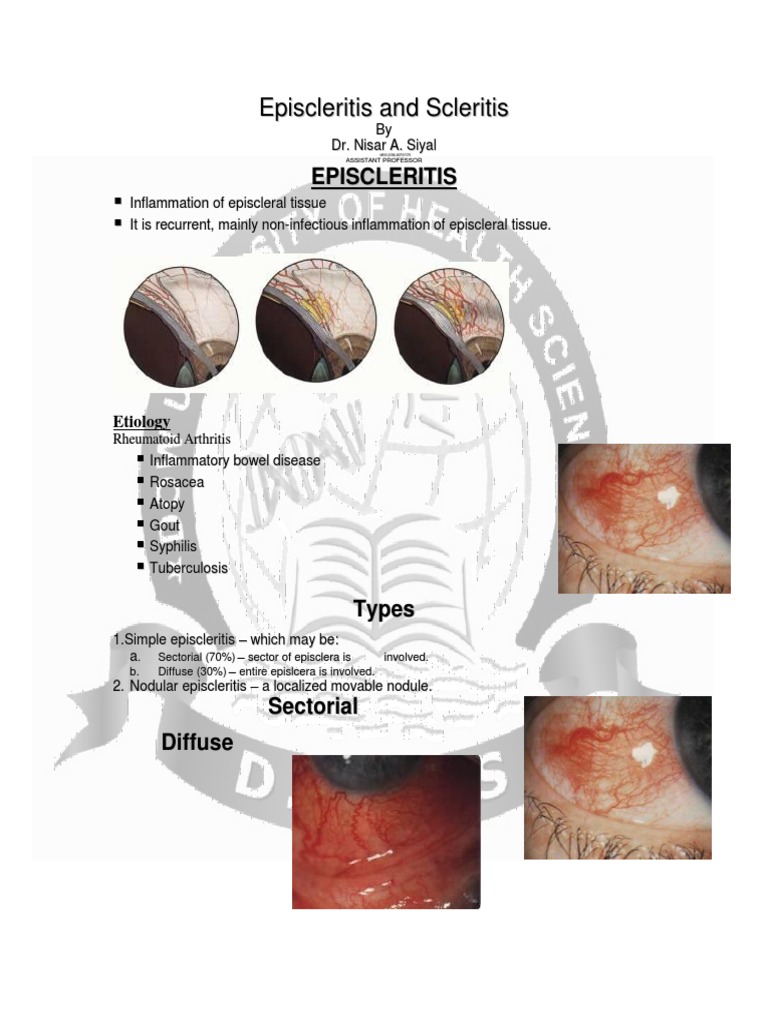 Lec2 Sem7 Year4 EYEwk2 2013 02 09 | PDF | Diseases Of The Eye And ...