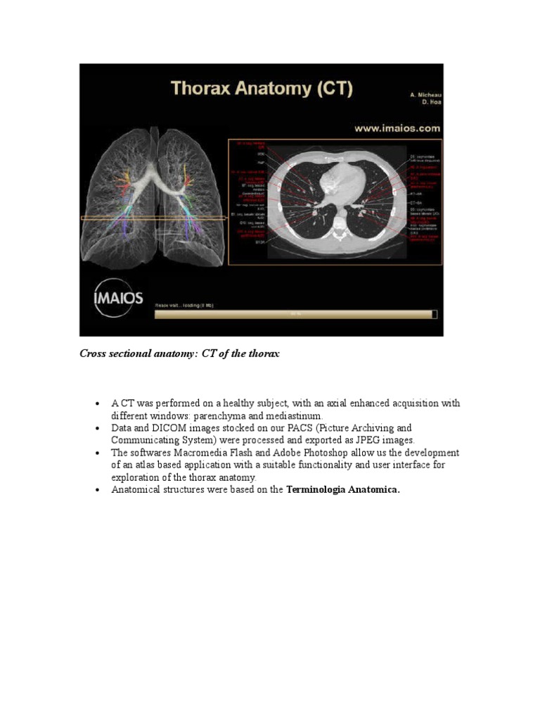 Cross Sectional Anatomy: CT of The Thorax | PDF | Science & Mathematics