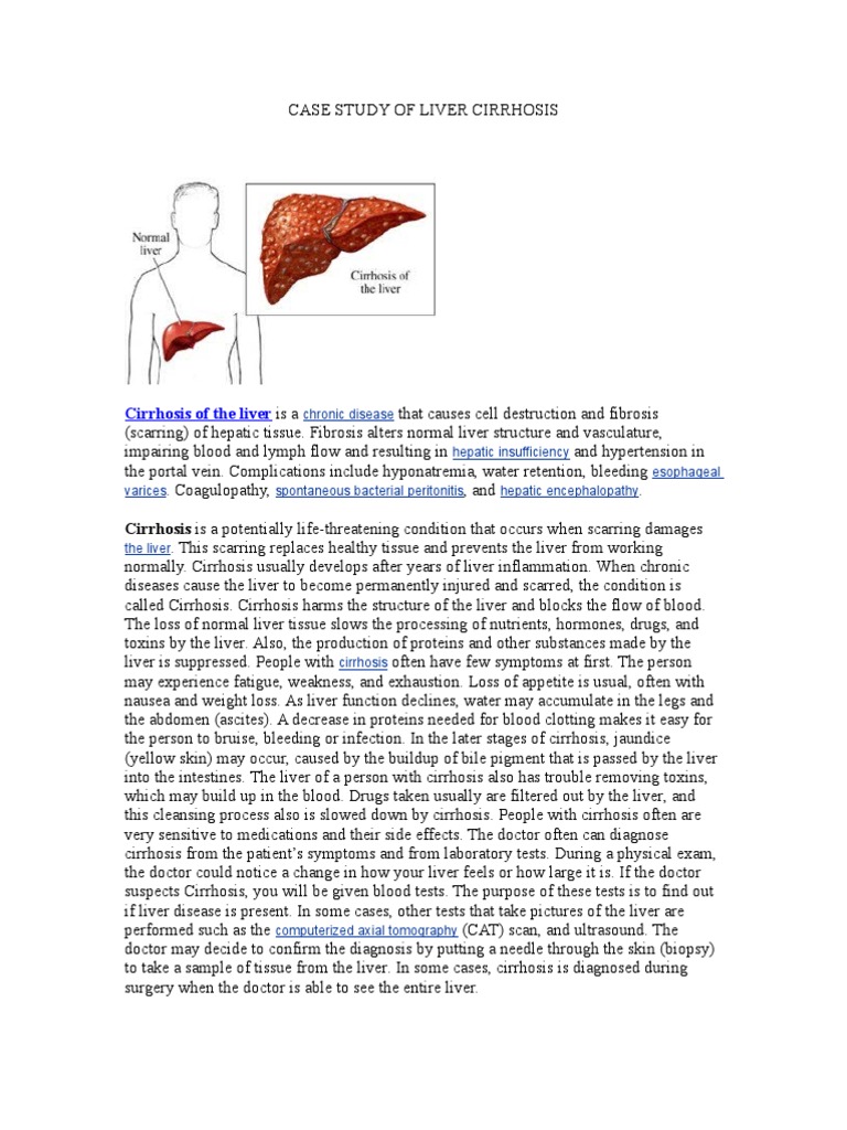 Liver cirrhosis case study scribd image
