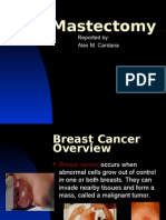 Mastectomy: Reported By: Alex M. Cardana