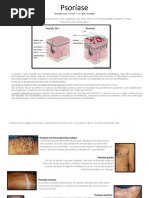 Psoríase
