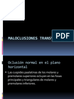 Maloclusiones Transversales