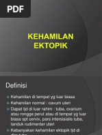 Download KEHAMILAN EKTOPIK by putridewi22 SN171776911 doc pdf