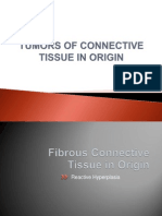 tumors of connective tissue