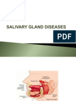 tumors of Salivary glands