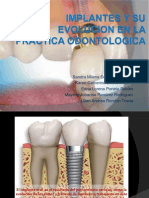 Implantes y Su Evolucion en La Practica Odontologica
