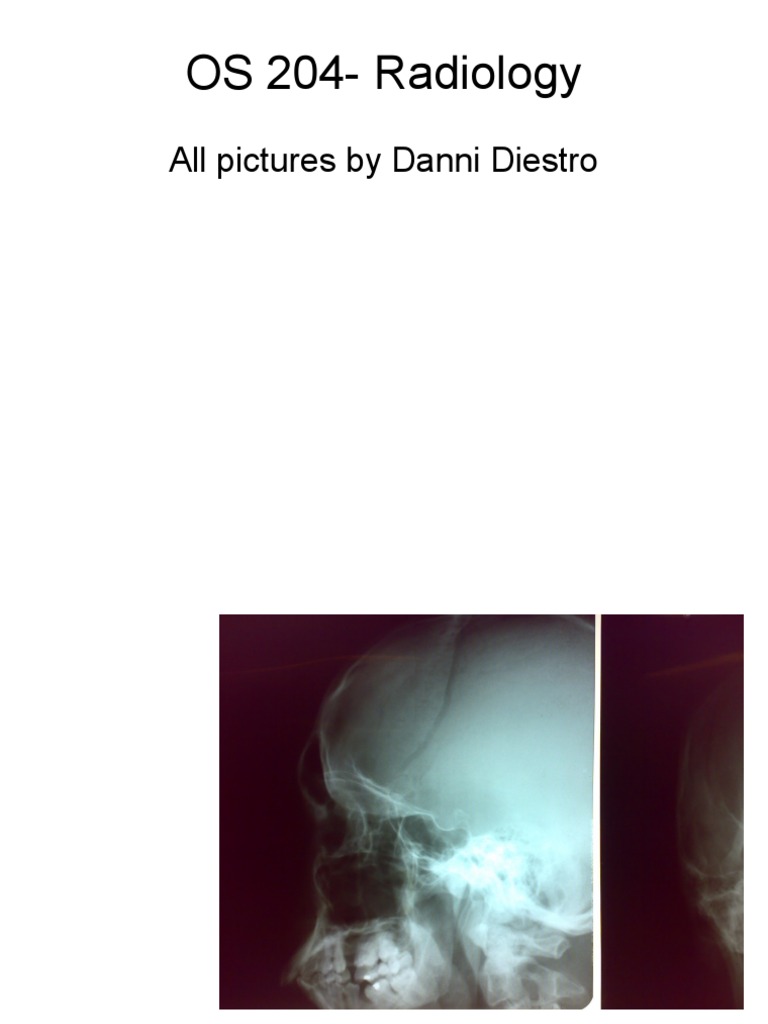 OS 204 - Radiology | PDF