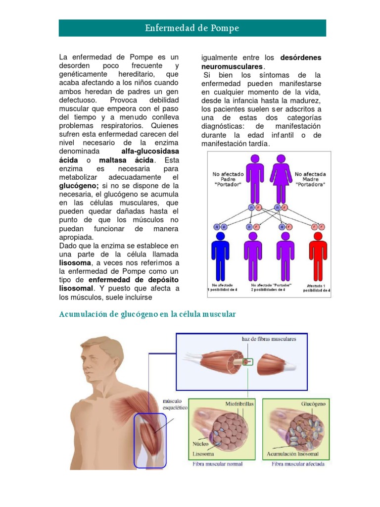 Enfermedad De Pompe Articulo Completo Pdf Enfermedades Y Trastornos Medicina Clinica