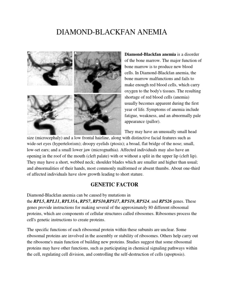 DiamondBlackfan Anemia Is A Disorder PDF Inflammation Biology