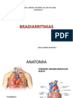 BRADIARRITMIAS