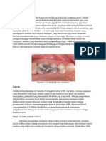 Amalgam Dental: Sejarah, Manfaat & Status Saat Ini