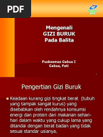 Download Gizi Buruk Ppt by Leo Chandra Wisnu P SN172695687 doc pdf