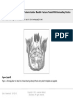 From:: A Comparison of Anterior Vs Posterior Isolated Mandible Fractures Treated With Intermaxillary Fixation Screws