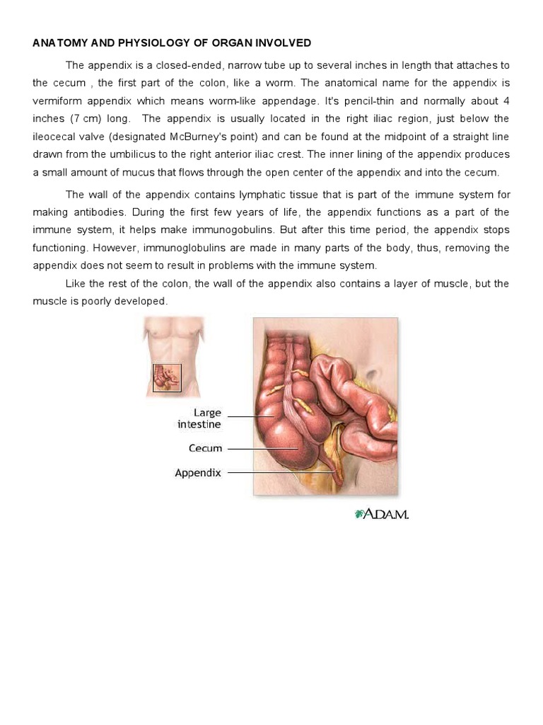 Understanding Appendicitis Anatomy | PDF | Inflammation | Anatomy