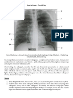 How To Read A Chest X Ray