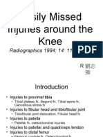 Easily Missed Injuries Around The Knee