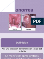 Gonorrea