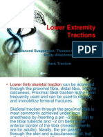 Lower Extremity Tractions: Balanced Suspension: Thomas Ring & Pearson & Brady Attachment Buck Traction