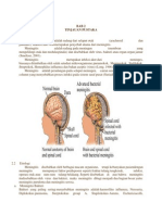 Meningitis