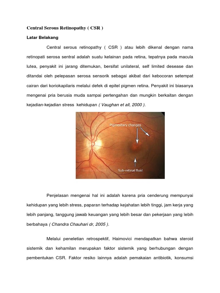 Retinopati Serosa Sentral: Penyebab dan Gejala | PDF | Sains & Matematika