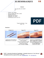 11 Fracture Hemoragique1 2002