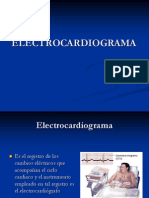 electrocardigrama-jv1