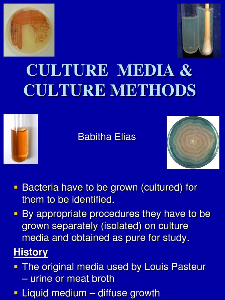research on culture media