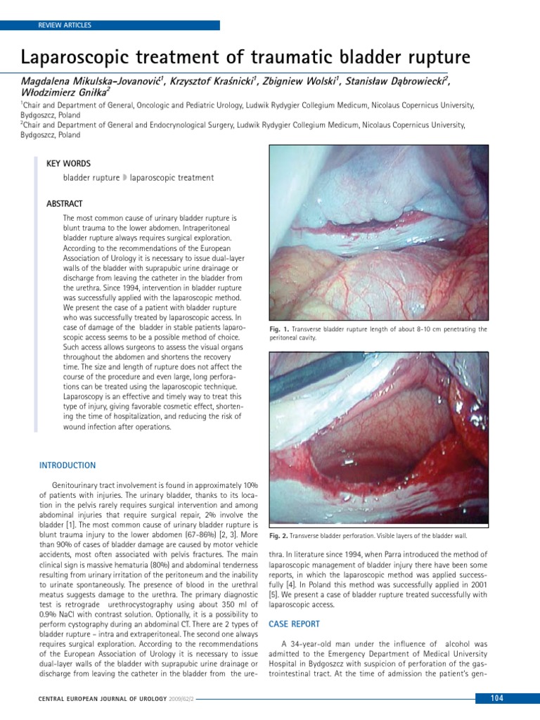 104 Laparoscopic Treatment of Traumatic Bladder Rupture Urology