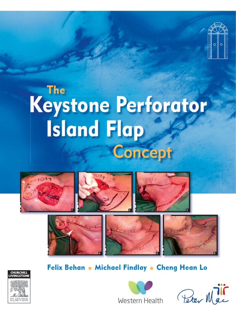 The Keystone Perforator Island Flap Concept Behan 9780729539715
